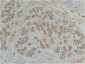 EphA1 Polyclonal Antibody