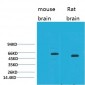 EAAT2 Polyclonal Antibody