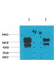 GABA A Receptor γ2 Polyclonal Antibody