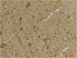 GABA A Receptor γ2 Polyclonal Antibody