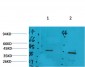 GALR2 Polyclonal Antibody