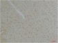 KCNK10 (TREK-2) Polyclonal Antibody