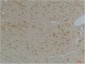 KChIP3 Polyclonal Antibody