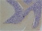 KChIP3 Polyclonal Antibody