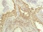 P70 S6 Kinase mouse Monoclonal Antibody(1C7)