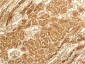 IL-8 mouse Monoclonal Antibody(14E1)