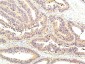STAT1 mouse Monoclonal Antibody(8H11)