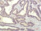 STAT1 mouse Monoclonal Antibody(5H7)