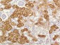 IL-8 mouse Monoclonal Antibody(8B1)