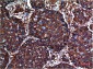AKT mouse Monoclonal Antibody(10D6)