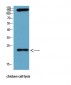 Bax mouse Monoclonal Antibody(6F11)