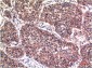 Phospho-Akt (S473) mouse Monoclonal Antibody(6F8)