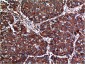 AKT mouse Monoclonal Antibody(1H2)