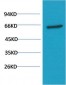 AKT mouse Monoclonal Antibody(1H2)