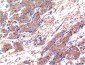 Bax mouse Monoclonal Antibody(1C1)