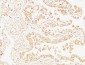 Cystatin C mouse Monoclonal Antibody(7F11)