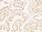 Cystatin C mouse Monoclonal Antibody(7F11)