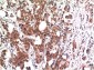 GSK3β mouse Monoclonal Antibody(2C6)