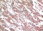 Phospho-Stat3 (Y705) mouse Monoclonal Antibody(1E9)