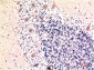 LC3B mouse Monoclonal Antibody(9H5)