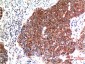 Beclin-1 mouse Monoclonal Antibody(5C2)