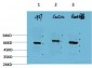 Beclin-1 mouse Monoclonal Antibody(5C2)