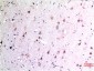 Beclin-1 mouse Monoclonal Antibody(5A11)