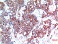 Beclin-1 mouse Monoclonal Antibody(5A11)