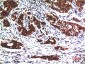 AKT mouse Monoclonal Antibody(1E11)