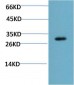 CHOP mouse Monoclonal Antibody(2B1)