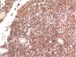 Tau mouse Monoclonal Antibody(10E3)