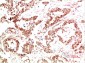 Met Rabbit Polyclonal Antibody