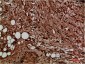 Met Rabbit Polyclonal Antibody