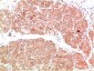 PI3 Kinase P85 Rabbit Polyclonal Antibody