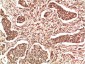 NM23A Rabbit Polyclonal Antibody