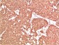 ATM Rabbit Polyclonal Antibody
