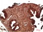 ATM Rabbit Polyclonal Antibody