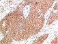 ATM mouse Monoclonal Antibody(1D1)