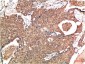 ATM mouse Monoclonal Antibody(3D3)