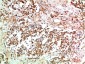 JAK2 Rabbit Polyclonal Antibody