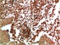 JNK2 Rabbit Polyclonal Antibody