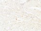 TTR mouse Monoclonal Antibody(1D7)