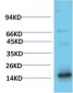 TTR mouse Monoclonal Antibody(1D7)