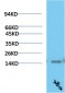 TTR mouse Monoclonal Antibody(2B12)