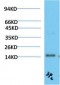 TTR mouse Monoclonal Antibody(3F2)