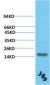 TTR mouse Monoclonal Antibody(3B5)