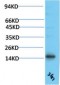 TTR mouse Monoclonal Antibody(3G7)