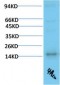 TTR mouse Monoclonal Antibody(4A12)