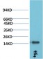 TTR mouse Monoclonal Antibody(4E4)