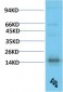 TTR mouse Monoclonal Antibody(5D2)